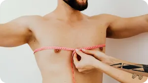 Cirugía de ginecomastia para corrección del exceso de tejido mamario masculino en Clínica La Parva.