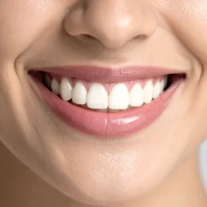 BLANQUEAMIENTO DENTAL (INCLUYE 3 SESIONES)