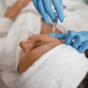 Ácido Hialurónico: BORDE MANDIBULAR