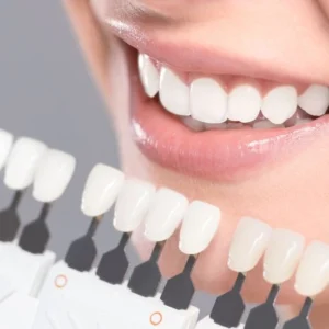 Blanqueamiento dental sillón + limpieza (incluye 3 sesiones)