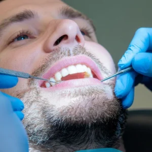 Endodoncia Anterior