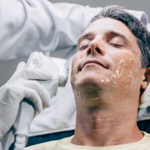 HIFU  papada 2 sesiones + limpieza facial de regalo