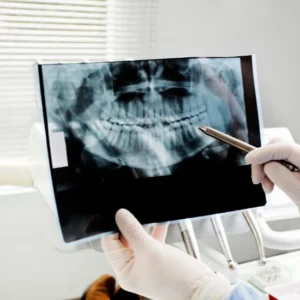Pack evaluación con radiografías + limpieza completa (destartraje ultrasónico + profilaxis)
