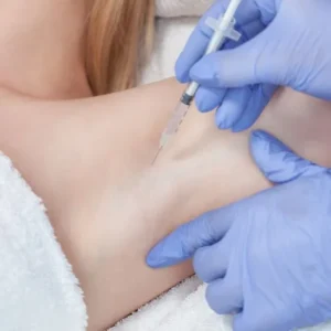 TOXINA BOTULÍNICA: "HIPERHIDROSIS"
